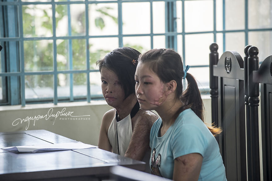 Can Tho City In Vietnam Opened The Trial Court Because Of The Intentionally Caused Injury With Acid