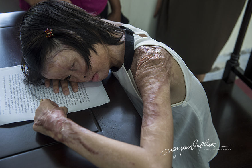 Can Tho City In Vietnam Opened The Trial Court Because Of The Intentionally Caused Injury With Acid Can Tho City In Vietnam Opened The Trial Court Because Of The Intentionally Caused Injury With Acid