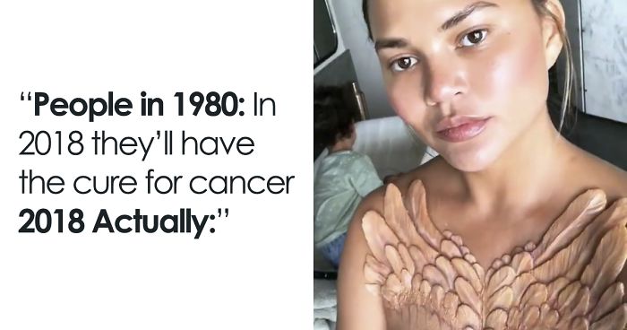 Celebrities Are Getting Temporary Skin “Implants” And It’s Freaking People Out