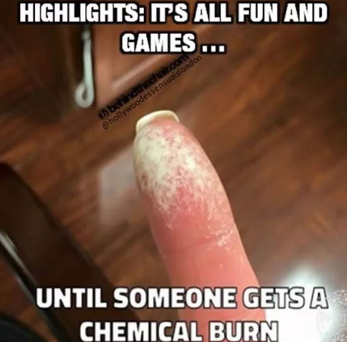 Finger with chemical burn, highlighting the challenges hairstylists face with hair treatments.