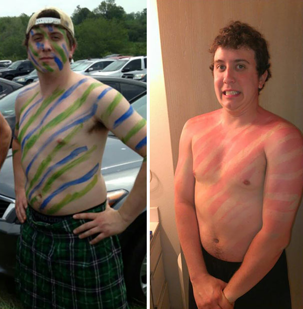 Warrior Forgot His Sunscreen