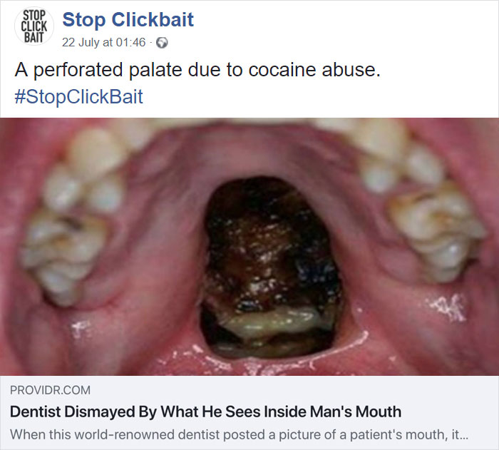 Stop Clickbait