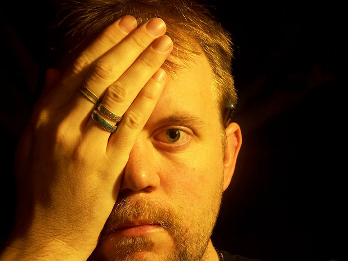 Man covering his left eye with a hand