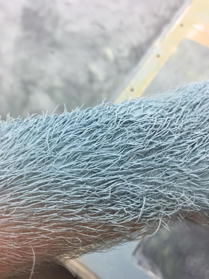 The Way This Dust Settled On My Arm Hair Makes It Look Like A Rug