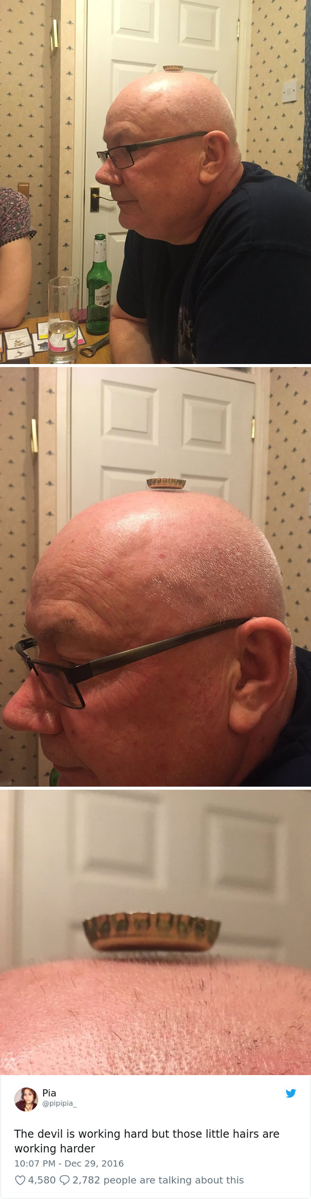 Bald dad with a bottle cap balanced on his head, showcasing his humorous talent.