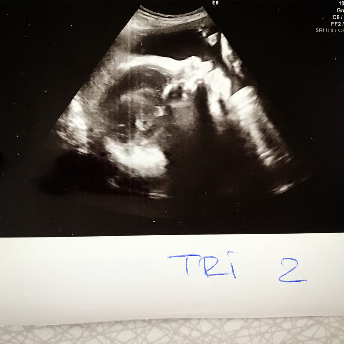 pregnant-triplets-mother-photos-denmark-5b976a0b5e932__700 pregnant-triplets-mother-photos-denmark-5b976a0b5e932__700