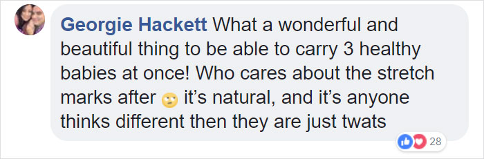 Here's What Being Pregnant With Triplets Does To Your Body Here's What Being Pregnant With Triplets Does To Your Body