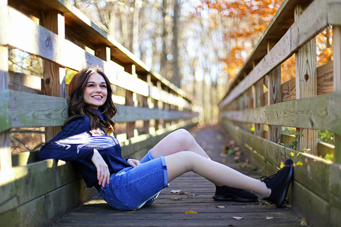 Girl Gets Her Leg Amputated At Age 11 Because Of Cancer, Becomes A Model 20 Years Later