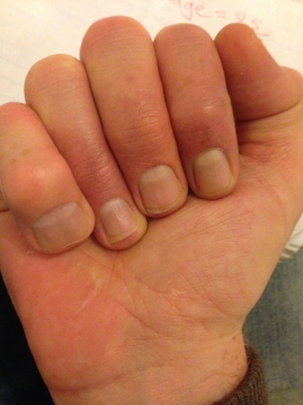 My Little Finger Is My Biggest Finger