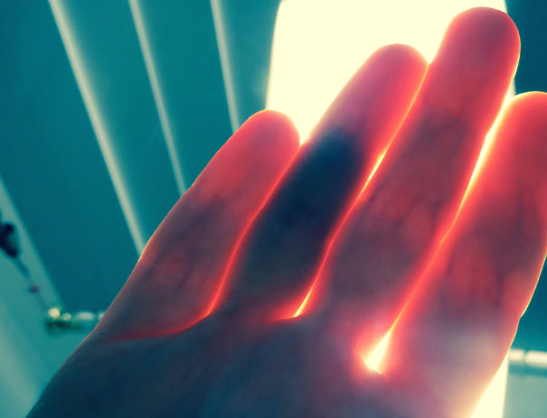 I Can See The Internal Bruising In My Finger When I Hold My Hand Up To The Light