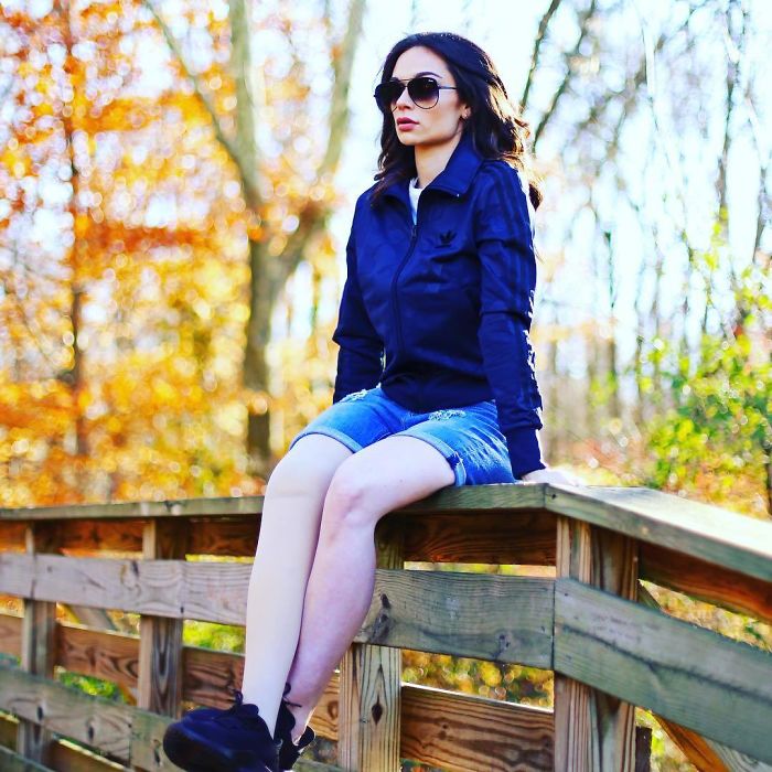 Girl Gets Her Leg Amputated At Age 11 Because Of Cancer, Becomes A Model 20 Years Later Girl Gets Her Leg Amputated At Age 11 Because Of Cancer, Becomes A Model 20 Years Later