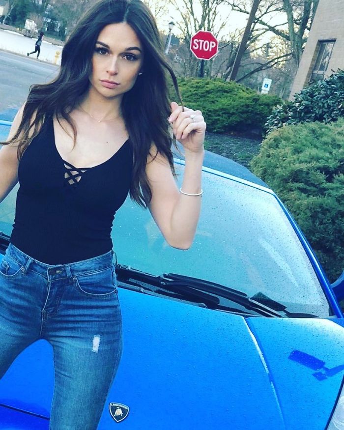 Girl Gets Her Leg Amputated At Age 11 Because Of Cancer, Becomes A Model 20 Years Later Girl Gets Her Leg Amputated At Age 11 Because Of Cancer, Becomes A Model 20 Years Later