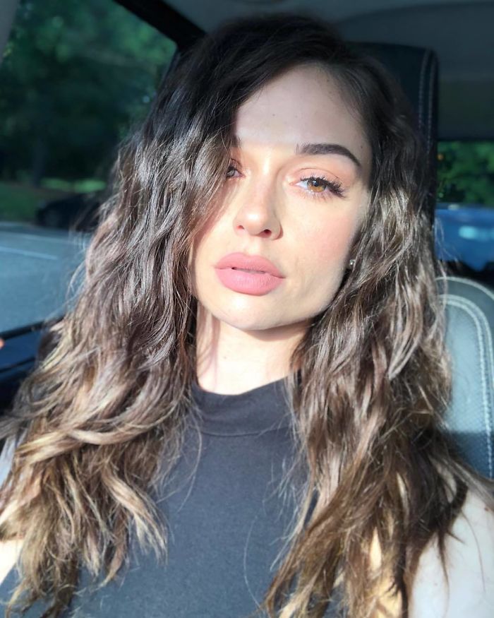 Girl Gets Her Leg Amputated At Age 11 Because Of Cancer, Becomes A Model 20 Years Later