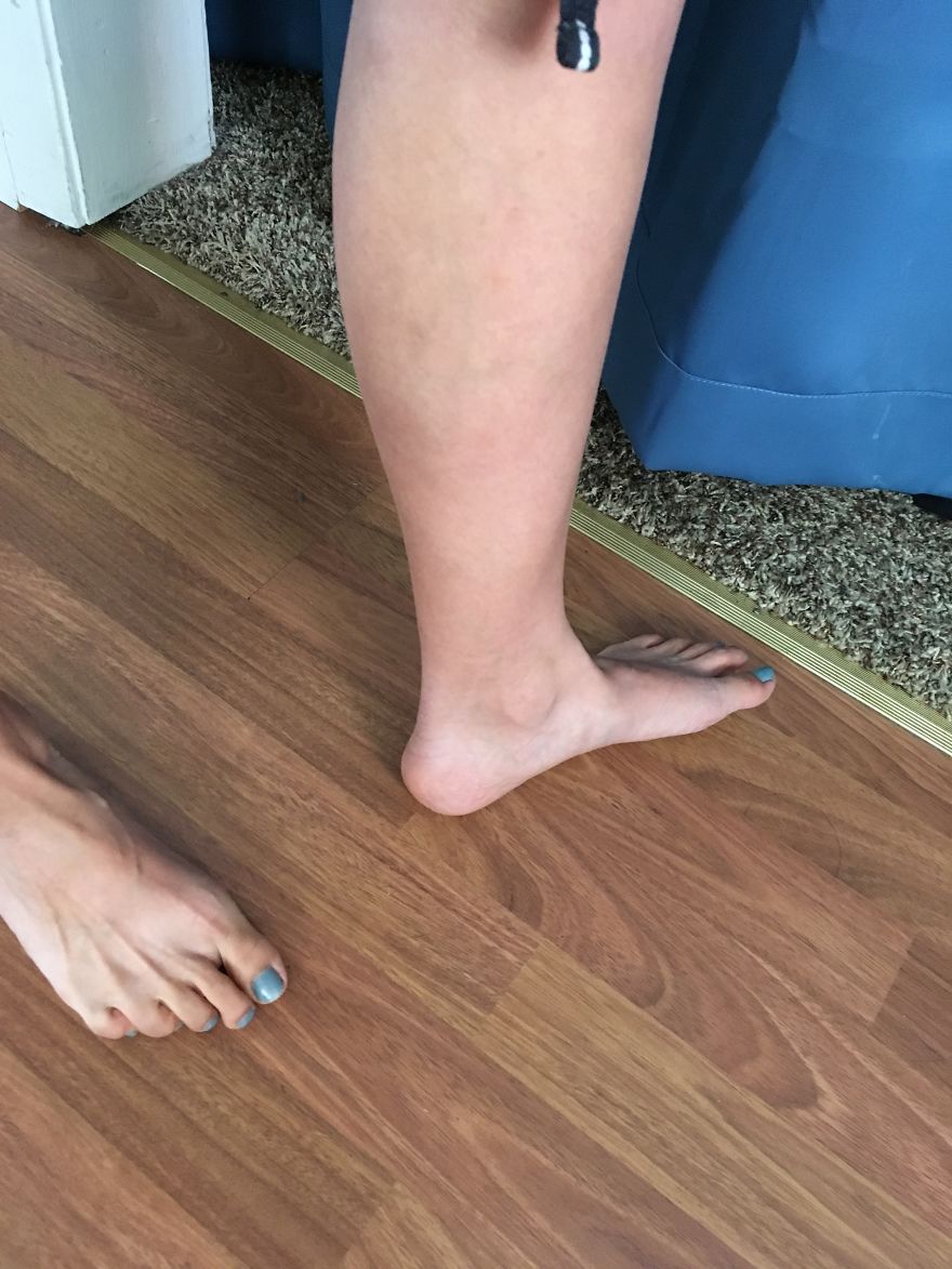 Does Anyone Have A Design Or Number In Their Veins?