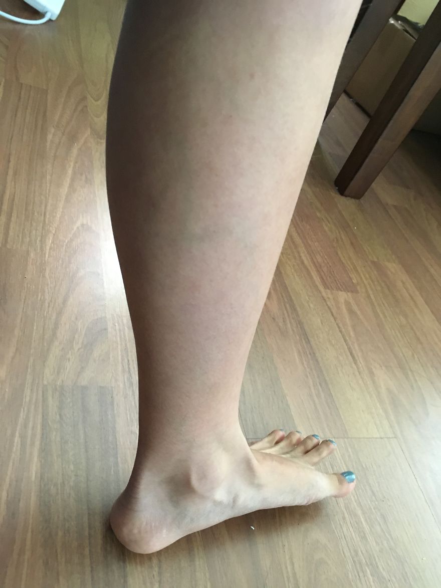 Does Anyone Have A Design Or Number In Their Veins?