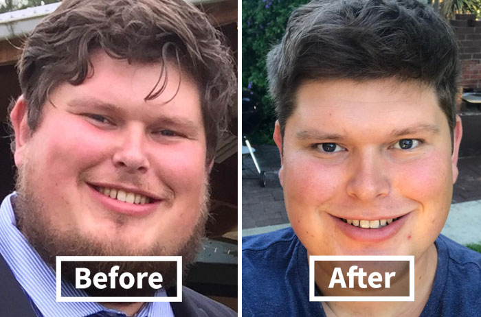 59 Before & After Pics That Show What Happens When You Stop Drinking