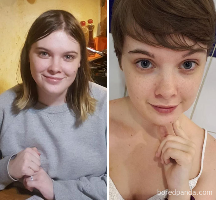 Lost 22 Lbs In 4 Months. I Didn't Realize How Much Weight I Stored On My Face