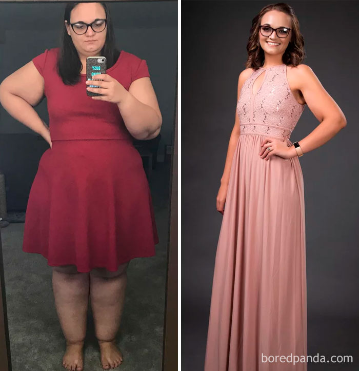 Lost 159 Lbs. October 2nd 2017 Vs September 2018 - Along With My Gastric Bypass In September 2017, Hard Work And Dedication, I’m Way Happier And Healthier Than Ever Before