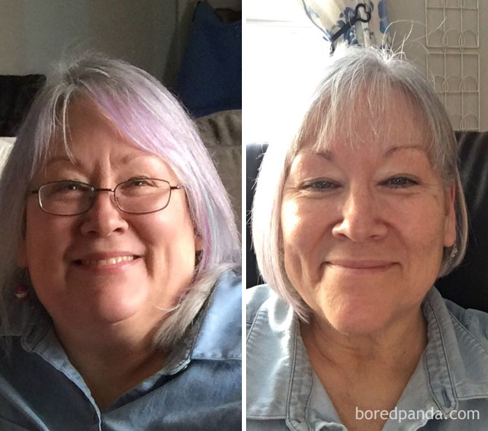 Lost 57 Lbs And My Double Chin