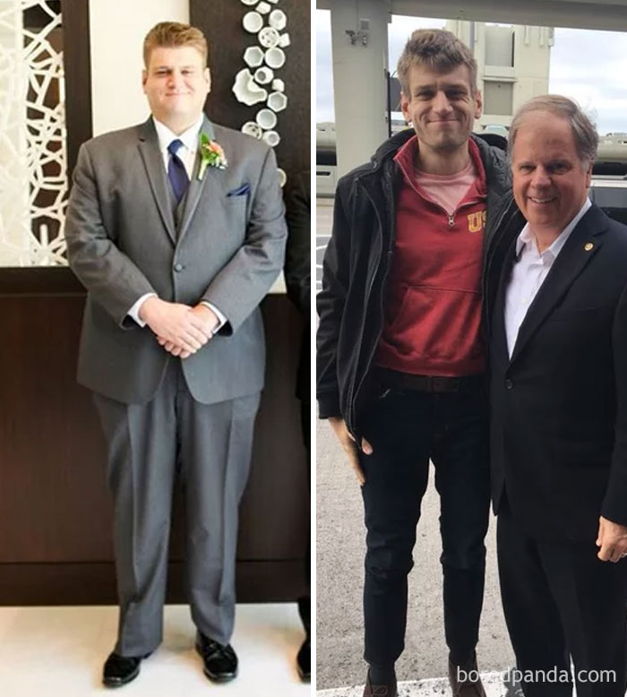 Lost 170 Lbs In 1 Year. From 310 To 175 Lbs