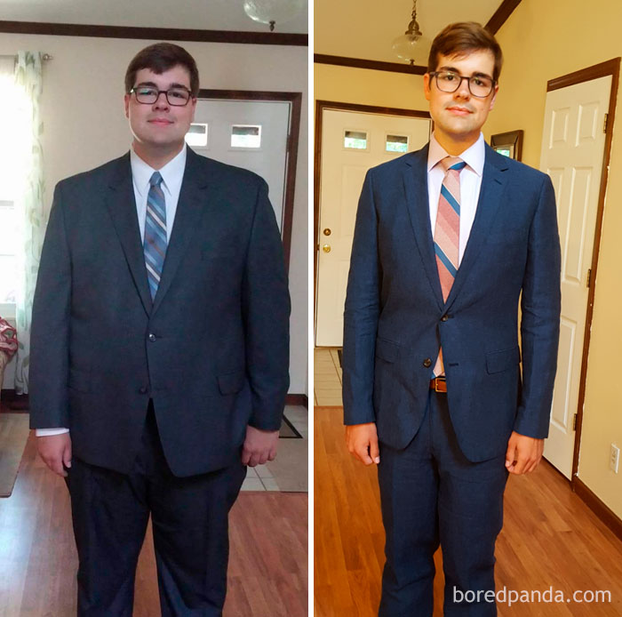 140 Lb Weight Loss And Living With It