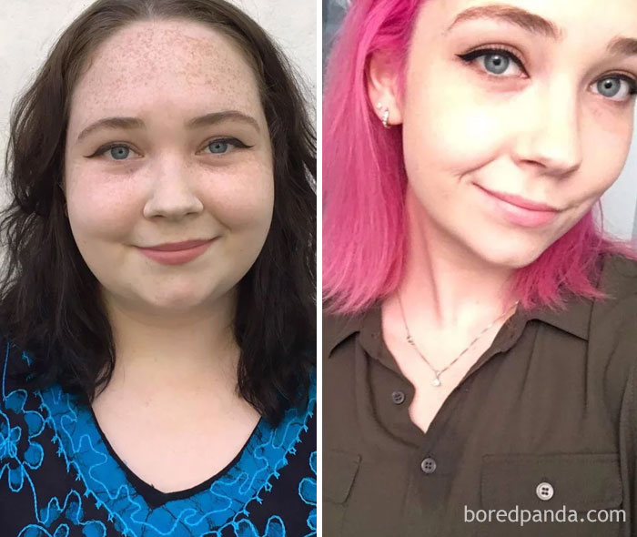 Lost 110 Lbs In 14 Months. Face Progress!