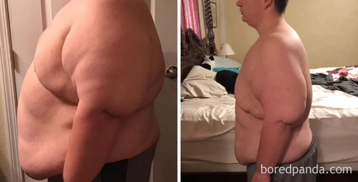 Lost 148 Lbs In 10 Months. Not Where I Want To Be Yet But I Am So Happy With My Progress