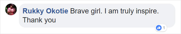 Girl Gets Her Leg Amputated At Age 11 Because Of Cancer, Becomes A Model 20 Years Later
