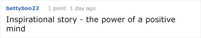 leg-amputated-model-tessa-snyder-16