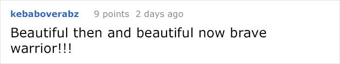 leg-amputated-model-tessa-snyder-17 leg-amputated-model-tessa-snyder-17