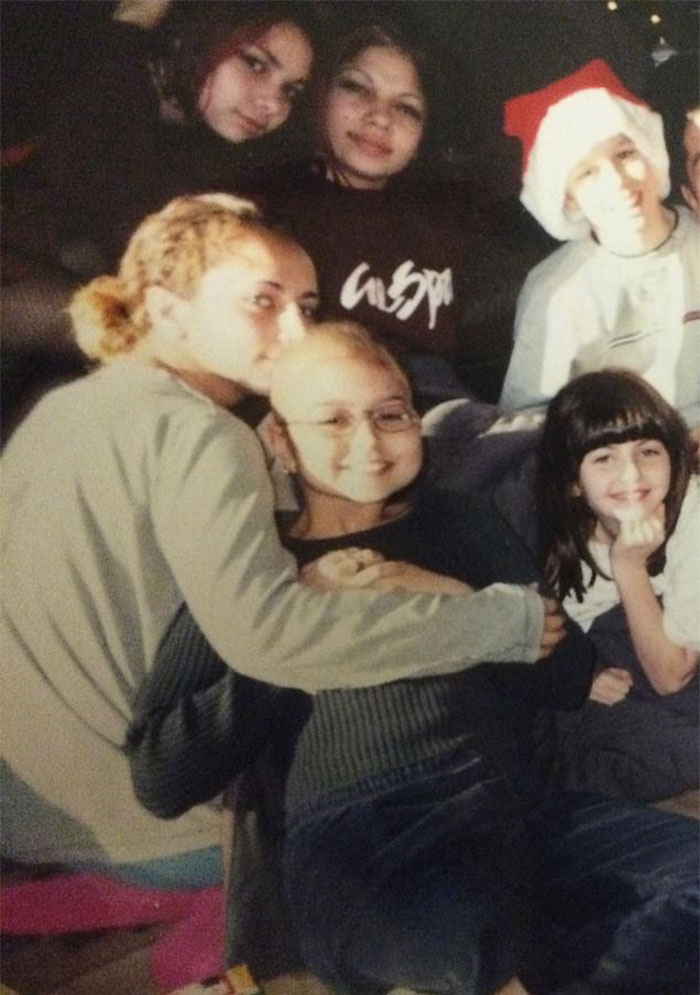 Girl Gets Her Leg Amputated At Age 11 Because Of Cancer, Becomes A Model 20 Years Later Girl Gets Her Leg Amputated At Age 11 Because Of Cancer, Becomes A Model 20 Years Later