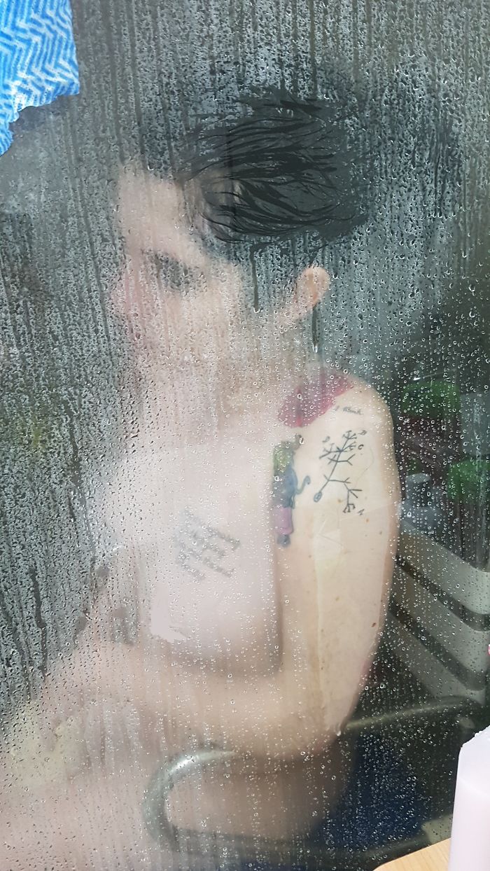 I'm Documenting Myself Slowly Dying From A Rare Disease To Show Why Euthanasia Should Be Legalized I'm Documenting Myself Slowly Dying From A Rare Disease To Show Why Euthanasia Should Be Legalized