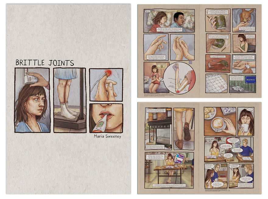 Brittle Joints: Comics About Living With A Rare Disability Brittle Joints: Comics About Living With A Rare Disability