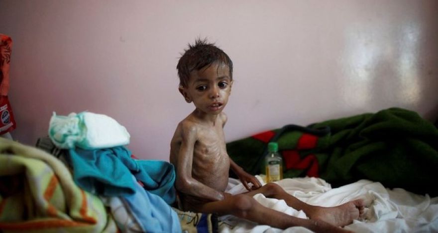 Please Help With The Biggest Humanitarian Crisis Happening In Yemen