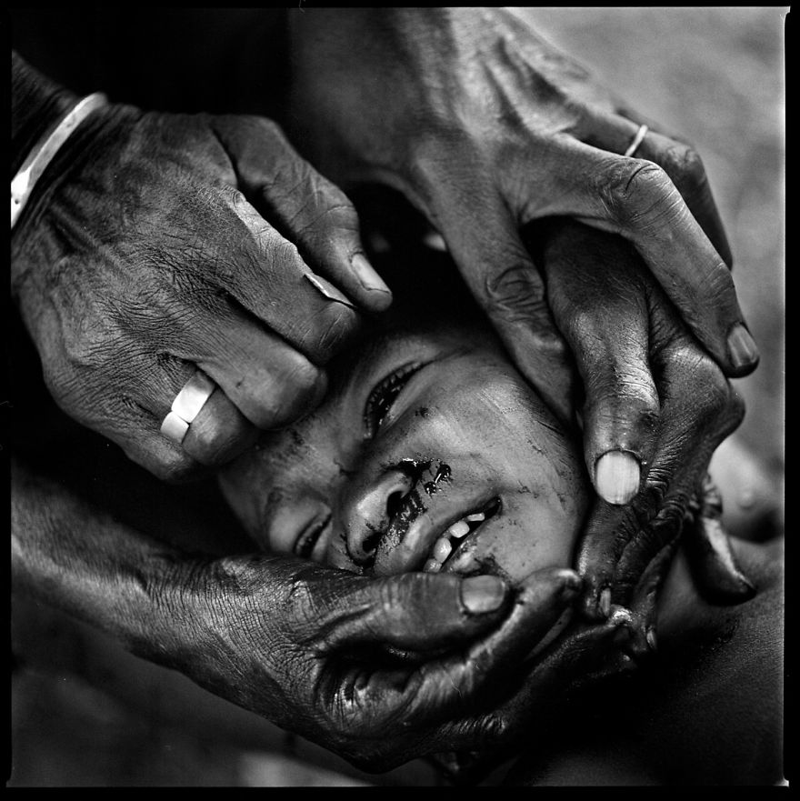 I've Seen The Ceremony Of Scarification In Africa I've Seen The Ceremony Of Scarification In Africa