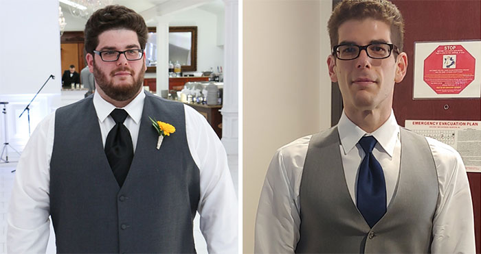 After Neglecting My Body For 10 Years, I Started Making Small Changes And Went From 300lbs To 150lbs