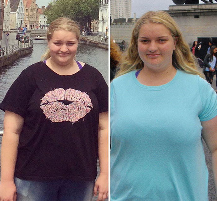 Overweight Teenager Surprises Everyone By Losing 139 Lbs To Fit Into Her Formal Dress