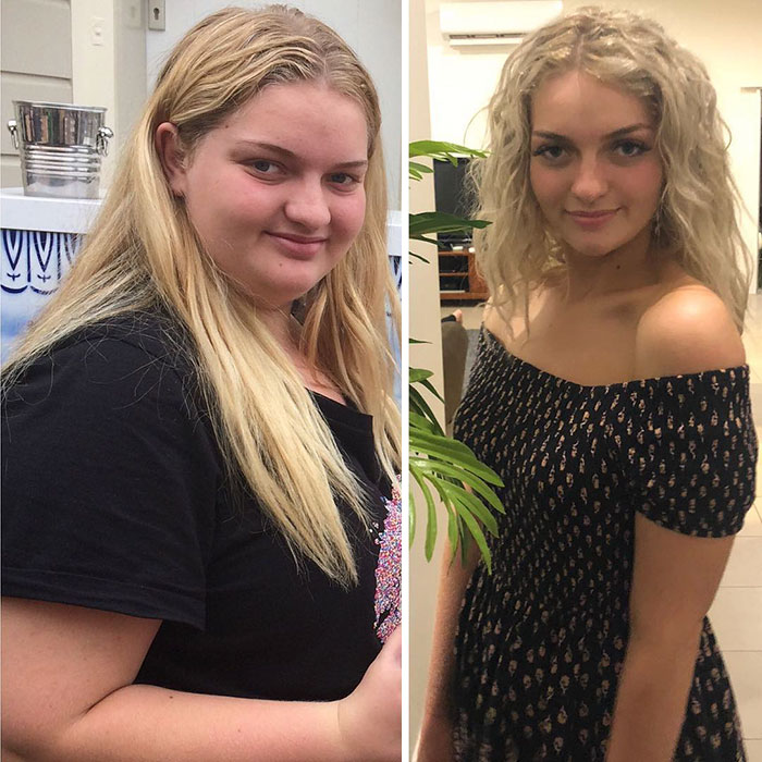 Overweight Teenager Surprises Everyone By Losing 139 Lbs To Fit Into Her Fo...