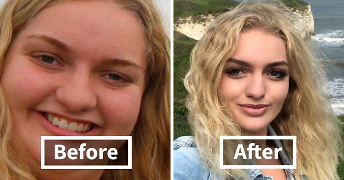 Overweight Teenager Surprises Everyone By Losing 139 Lbs To Fit Into Her Formal Dress