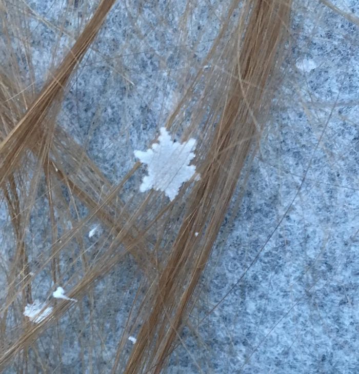 A Perfect Snowflake Caught In My Hair This Morning!
