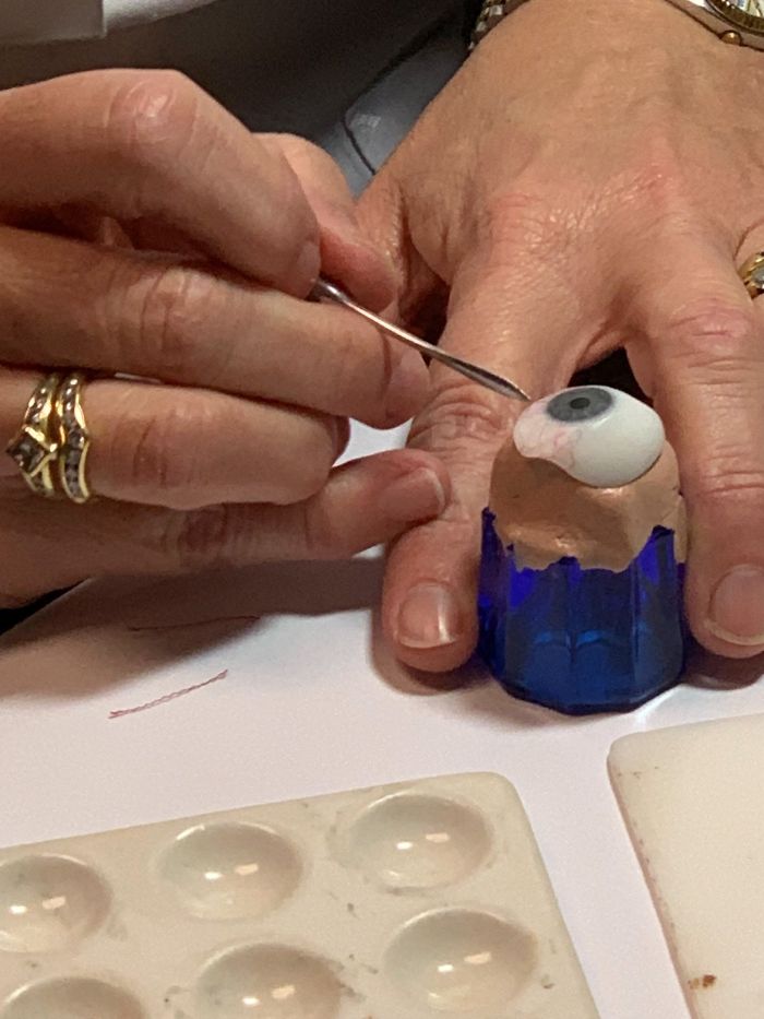 7 Months Ago My Husband Lost His Eye, I Documented The Weekend When He Finally Got A New One (Warning: Sensitive Content) 7 Months Ago My Husband Lost His Eye, I Documented The Weekend When He Finally Got A New One (Warning: Sensitive Content)