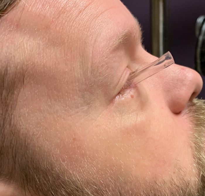 7 Months Ago My Husband Lost His Eye, I Documented The Weekend When He Finally Got A New One (Warning: Sensitive Content) 7 Months Ago My Husband Lost His Eye, I Documented The Weekend When He Finally Got A New One (Warning: Sensitive Content)