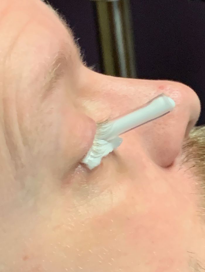 7 Months Ago My Husband Lost His Eye, I Documented The Weekend When He Finally Got A New One (Warning: Sensitive Content)