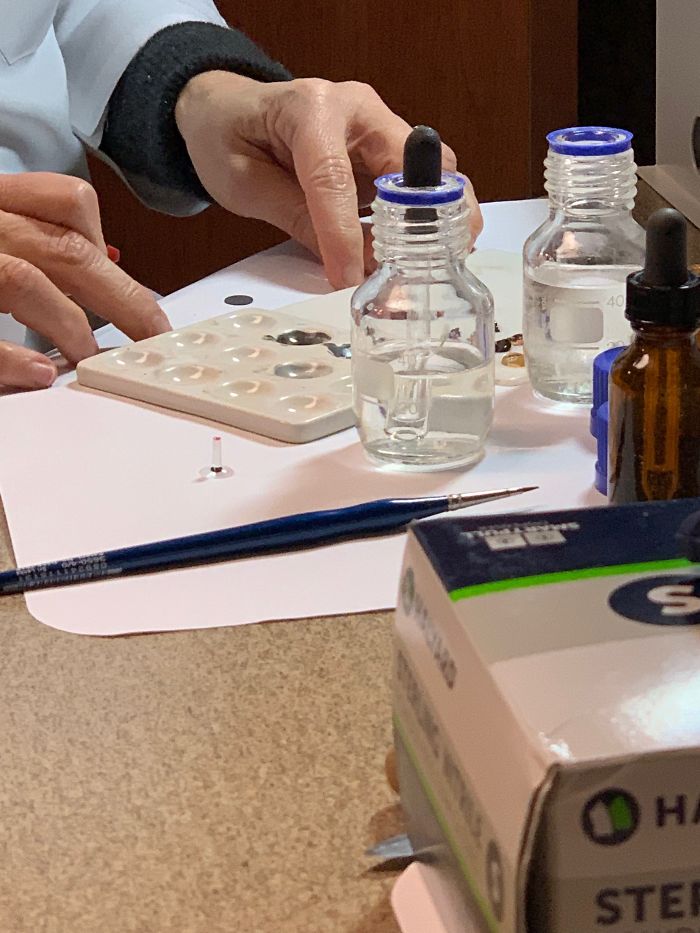 7 Months Ago My Husband Lost His Eye, I Documented The Weekend When He Finally Got A New One (Warning: Sensitive Content)