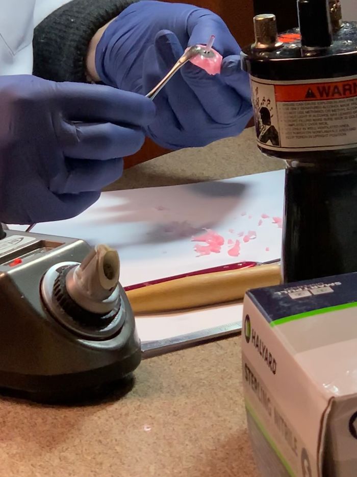 7 Months Ago My Husband Lost His Eye, I Documented The Weekend When He Finally Got A New One (Warning: Sensitive Content) 7 Months Ago My Husband Lost His Eye, I Documented The Weekend When He Finally Got A New One (Warning: Sensitive Content)