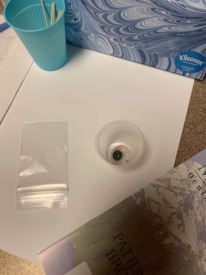 7 Months Ago My Husband Lost His Eye, I Documented The Weekend When He Finally Got A New One (Warning: Sensitive Content) 7 Months Ago My Husband Lost His Eye, I Documented The Weekend When He Finally Got A New One (Warning: Sensitive Content)