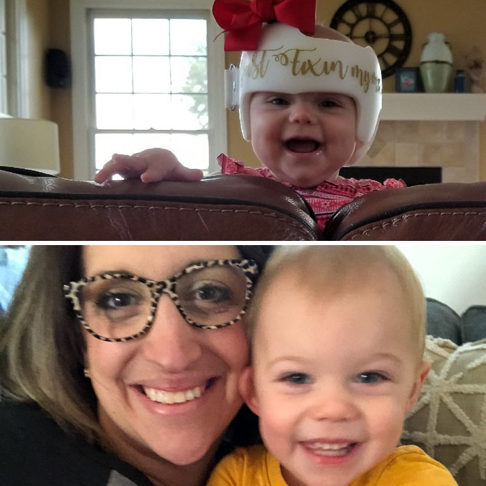 We Are Helmet Graduates! It Will Be Over Before You Know It. Plus, It Is Sneaky Adorable.