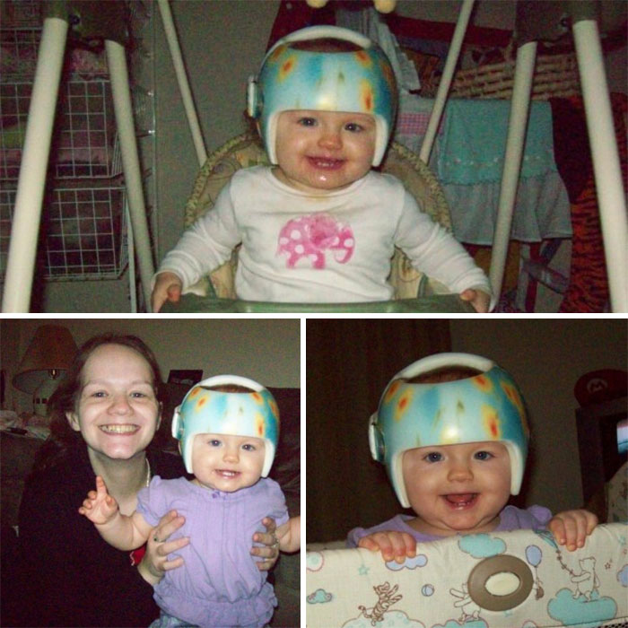 Helmet Babies Are The Best!!!!