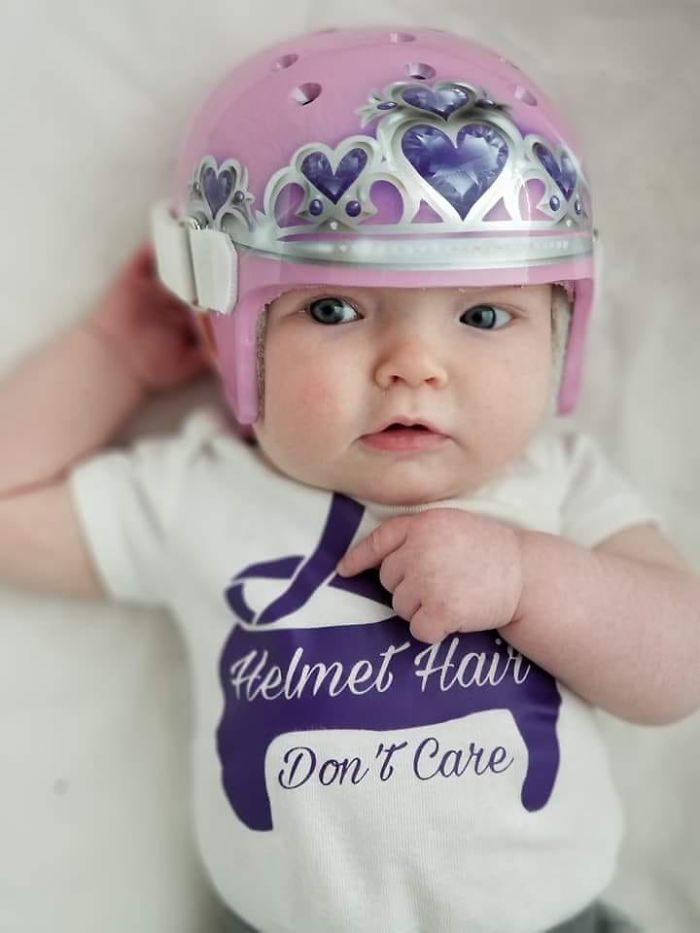 Because Every Princess Needs A Crown. 😍 My Little Cranio Princess!