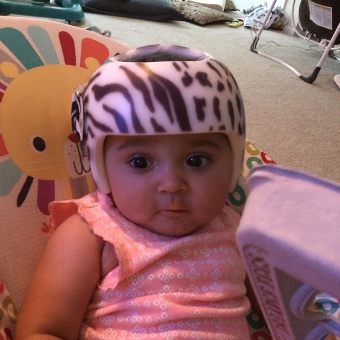 This Is My Little One She’s 3 Now But Her Head Is Round And She’s Happy. We Used To Call Her Baby Magneto And Her Twin Sister Was Professor X